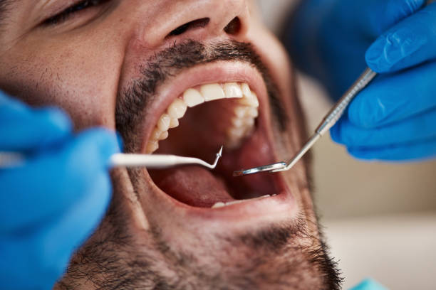 Best After-Hours Emergency Dentist in Cushing, OK