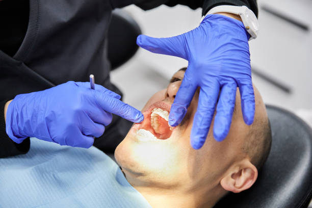 Best Emergency Tooth Extraction in Cushing, OK
