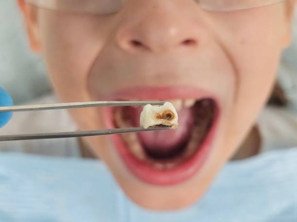 Best Pediatric Emergency Dentist in Cushing, OK